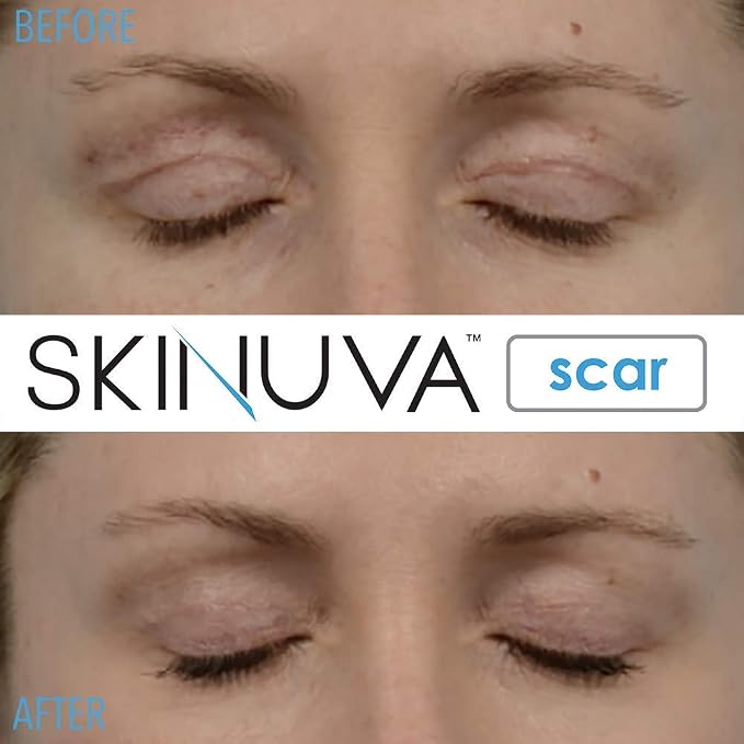 Scar