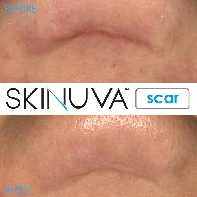 Scar
