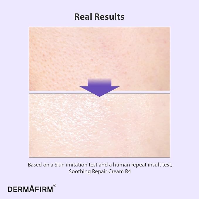 04. Soothing Repair Cream R4