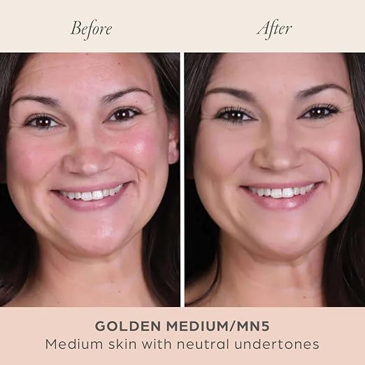 09. MN5/Golden Medium