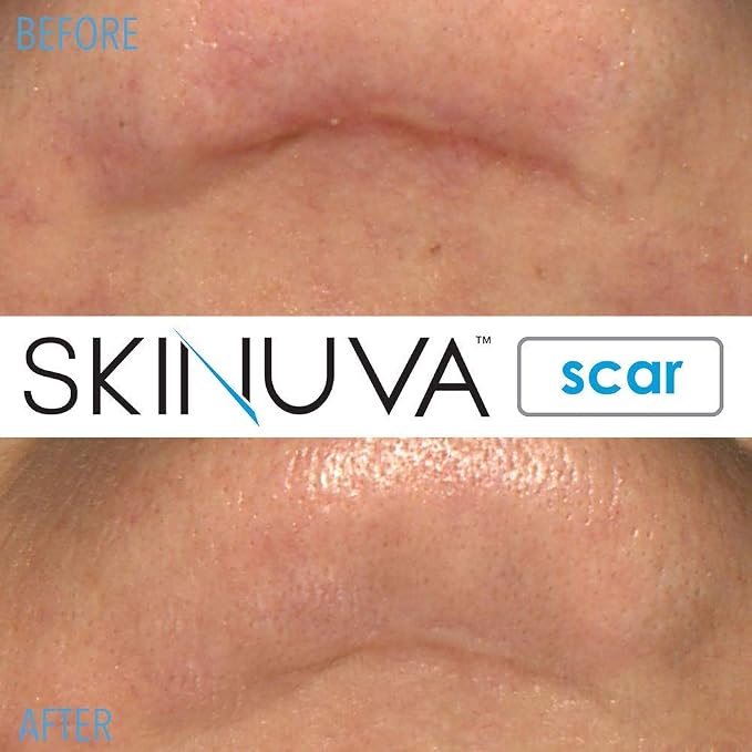 Scar