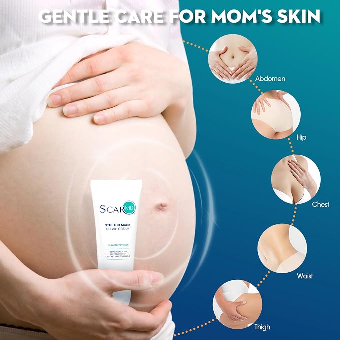 3.52 f oz Stretch Mark Repair Cream