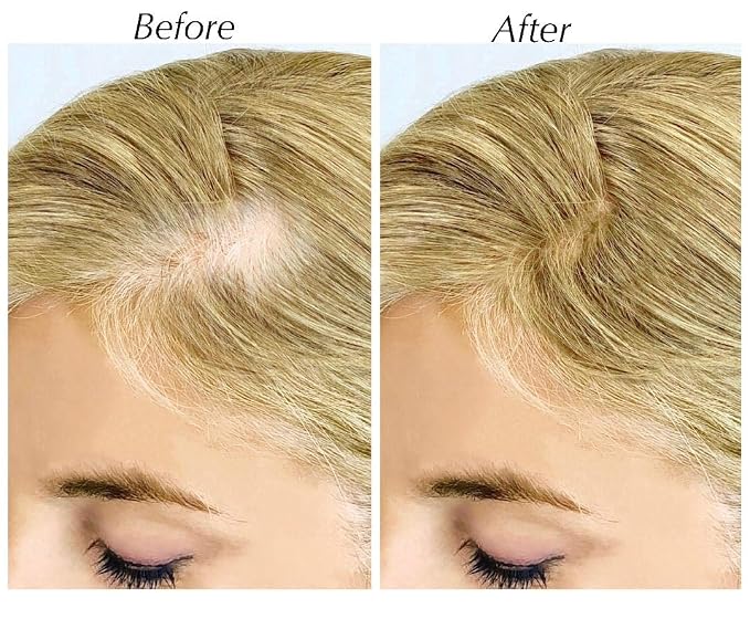 Blonde