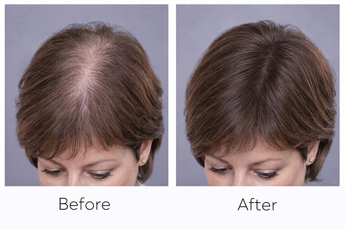 Medium Brown