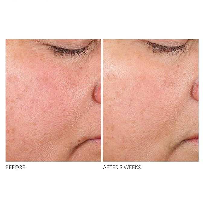 Retinol and Ferulic