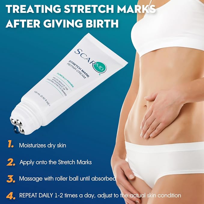 3.52 f oz Stretch Mark Repair Cream