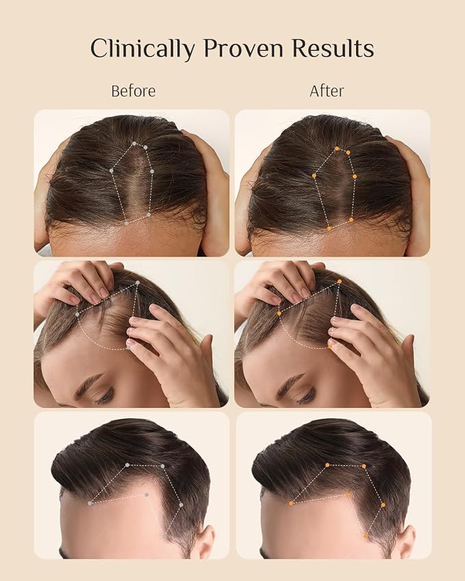 A-Redenical Shampoo