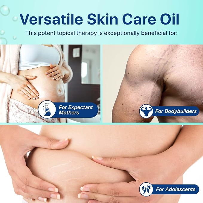 4.06 f oz Stretch Mark Oil