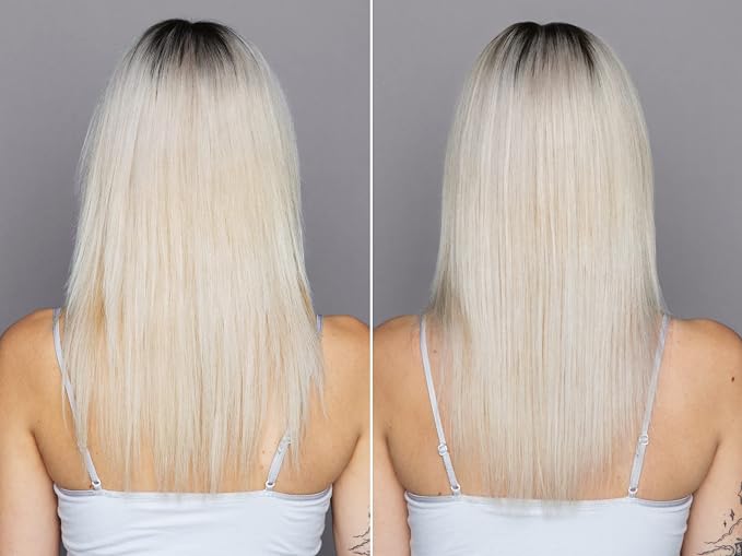 Platinum