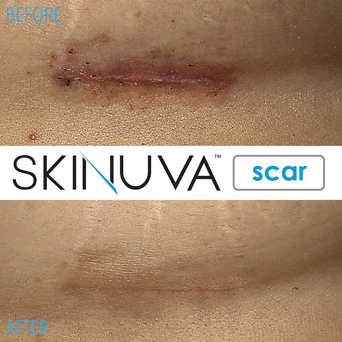Scar