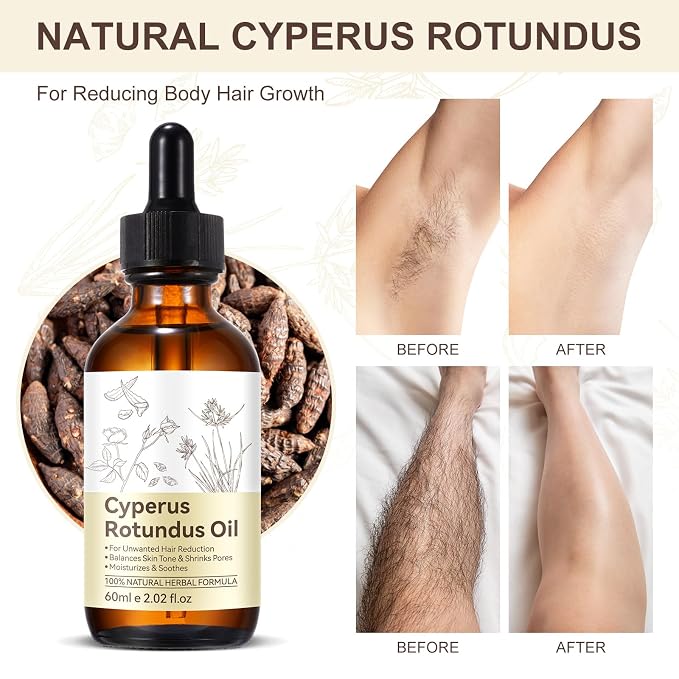 60ml Cyperus Rotundus Oil