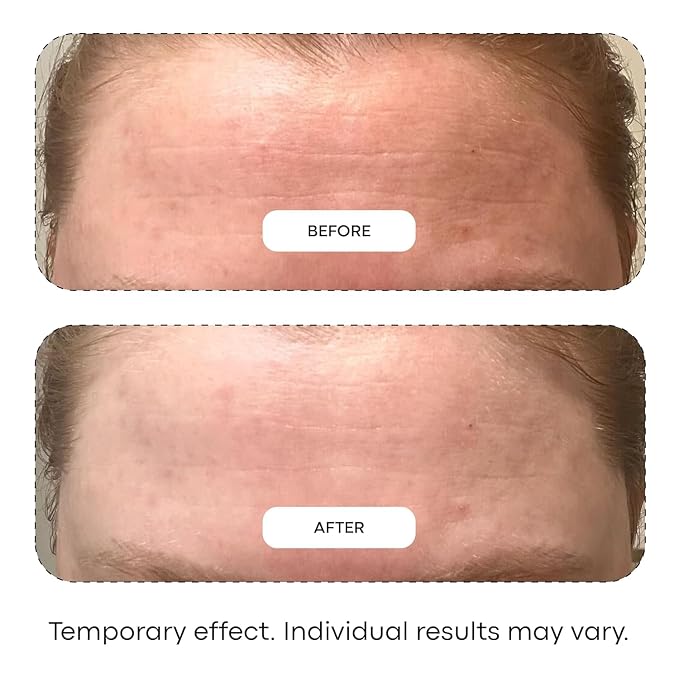 Phyto Mucin VNM Peptide 4 Pack