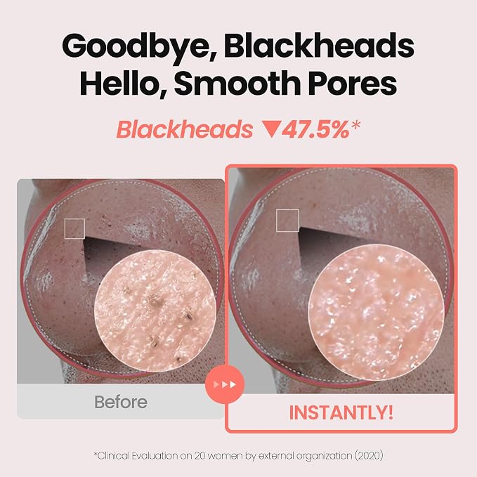 Rose Vitamin Brightening