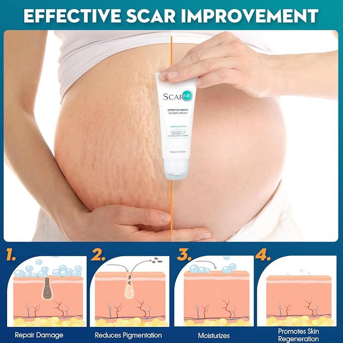 3.52 f oz Stretch Mark Repair Cream