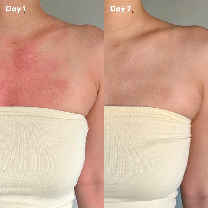 __DEFAULT__