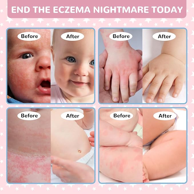 Baby Cream