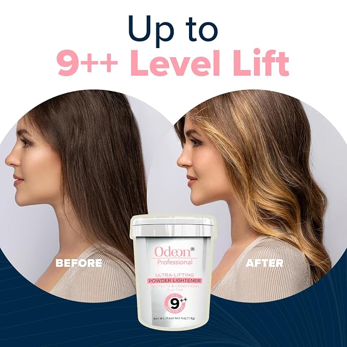 Up to 11 Levels