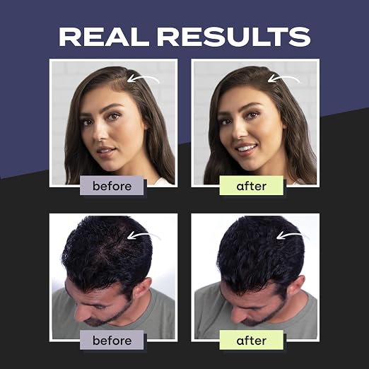 __DEFAULT__