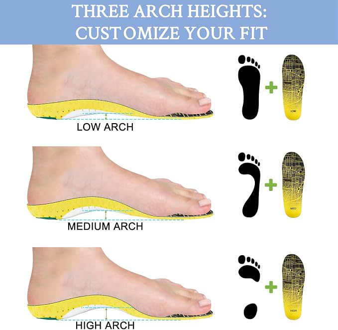 High Arch