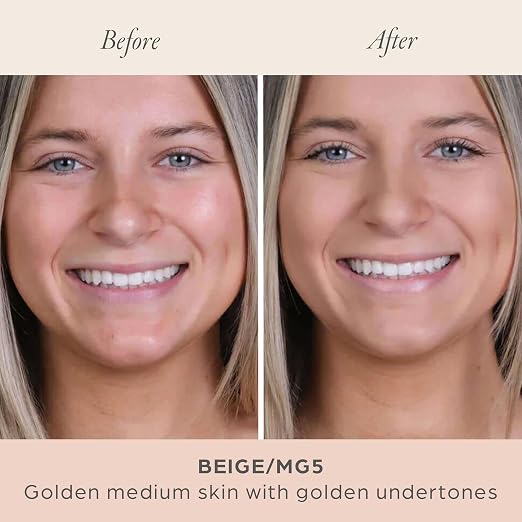 10. MG5/Beige