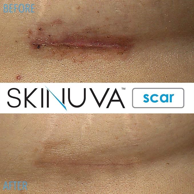Scar