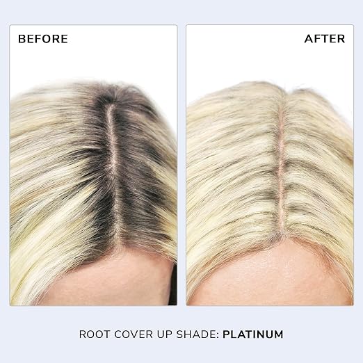 Platinum