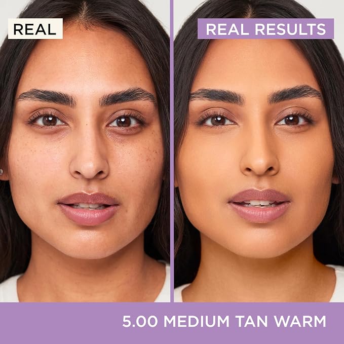 H. 4.25—Medium skin with neutral undertones