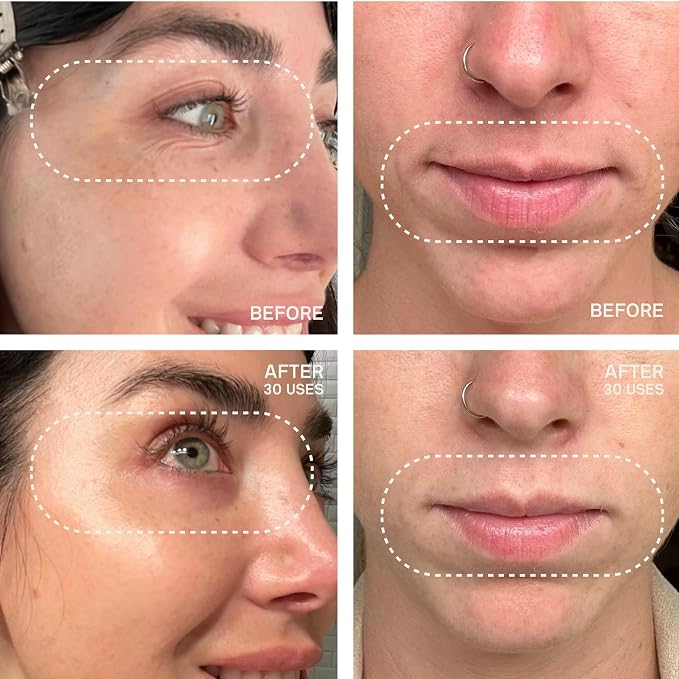 Eyes & Mouth Patches