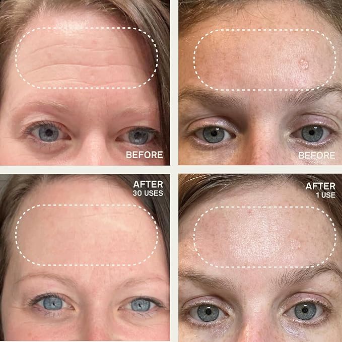 Forehead and Eyes & Mouth Patches