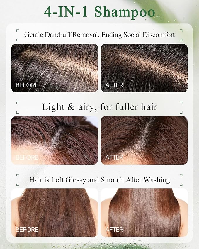 Scalp Care Set