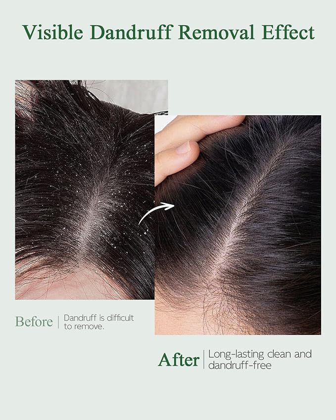 Scalp Essence 2Pcs